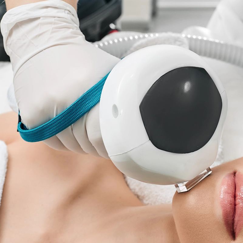 Close-up of skin showing reduced sun damage and brown spots after IPL photofacial treatment - SkinScience