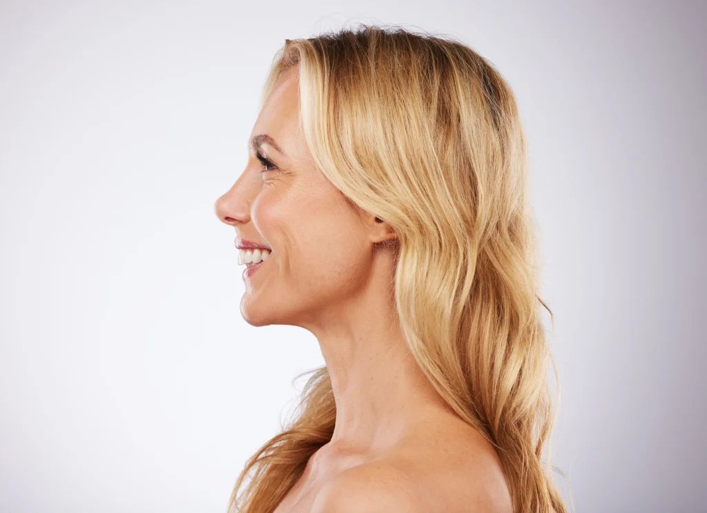 Woman with a lifted, defined lower face after intraoral Erbium skin tightening in Calgary - SkinScience