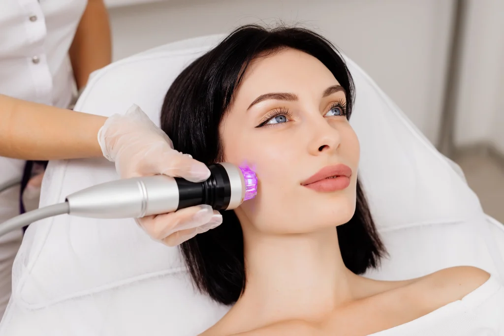 Close-up of skin showing refined texture and reduced scarring after RF microneedling sessions - SkinScience