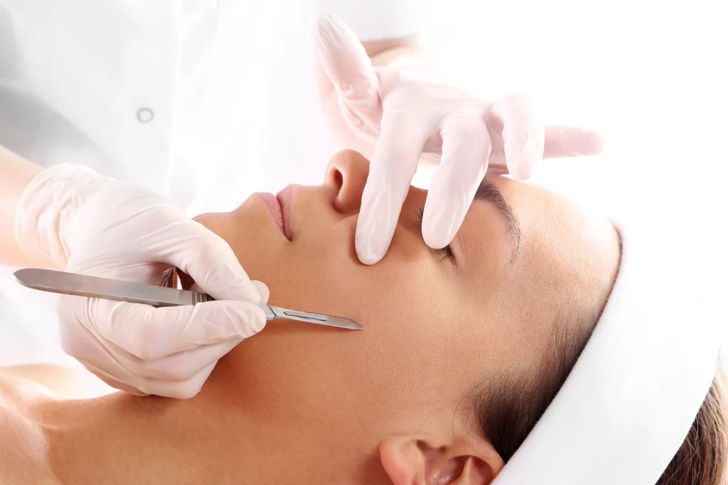 Esthetician performing dermaplaning to gently exfoliate and remove peach fuzz from the face - SkinScience Esthetician performing dermaplaning to gently exfoliate and remove peach fuzz from the face - SkinScience